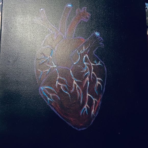 Original Heart - Picture 3 of 5